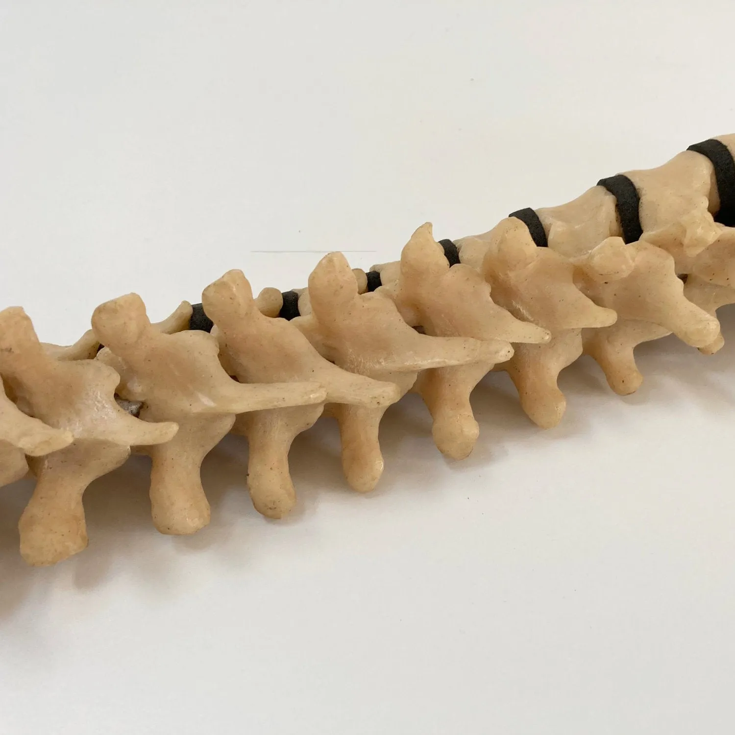 Scoliosis Spinal Column Model by Educational & Scientific Plastics Ltd