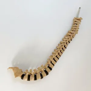 Scoliosis Spinal Column Model by Educational & Scientific Plastics Ltd