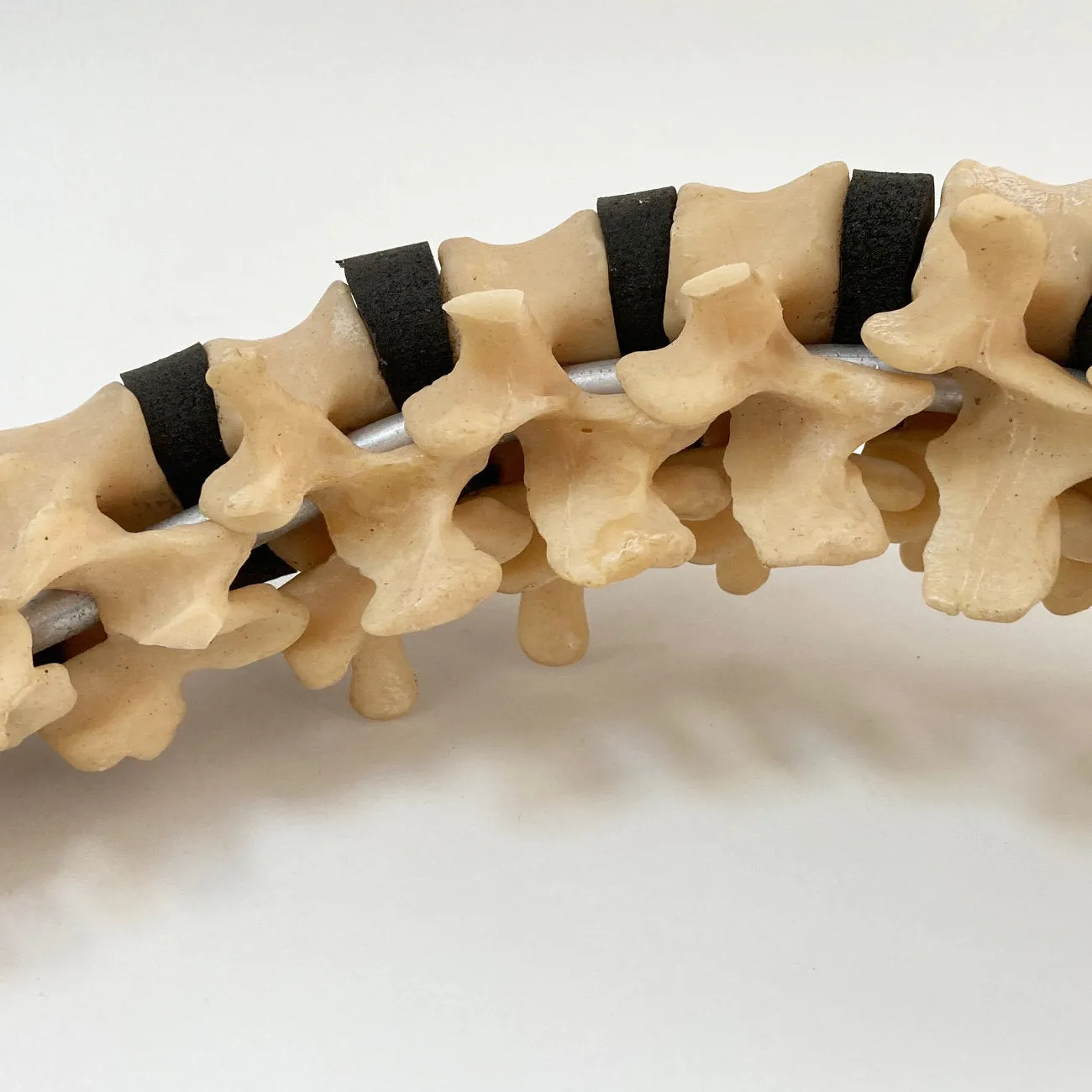 Scoliosis Spinal Column Model by Educational & Scientific Plastics Ltd